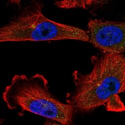 KIFC1 Antibody, Novus Biologicals 25 &mu;L; Unlabeled:Antibodies, Polyclonal